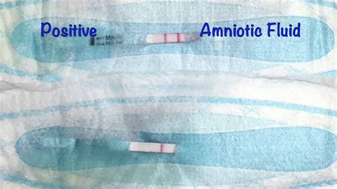 how to tell if your leaking amniotic fluid|Leaking amniotic fluid (premature rupture of membranes)